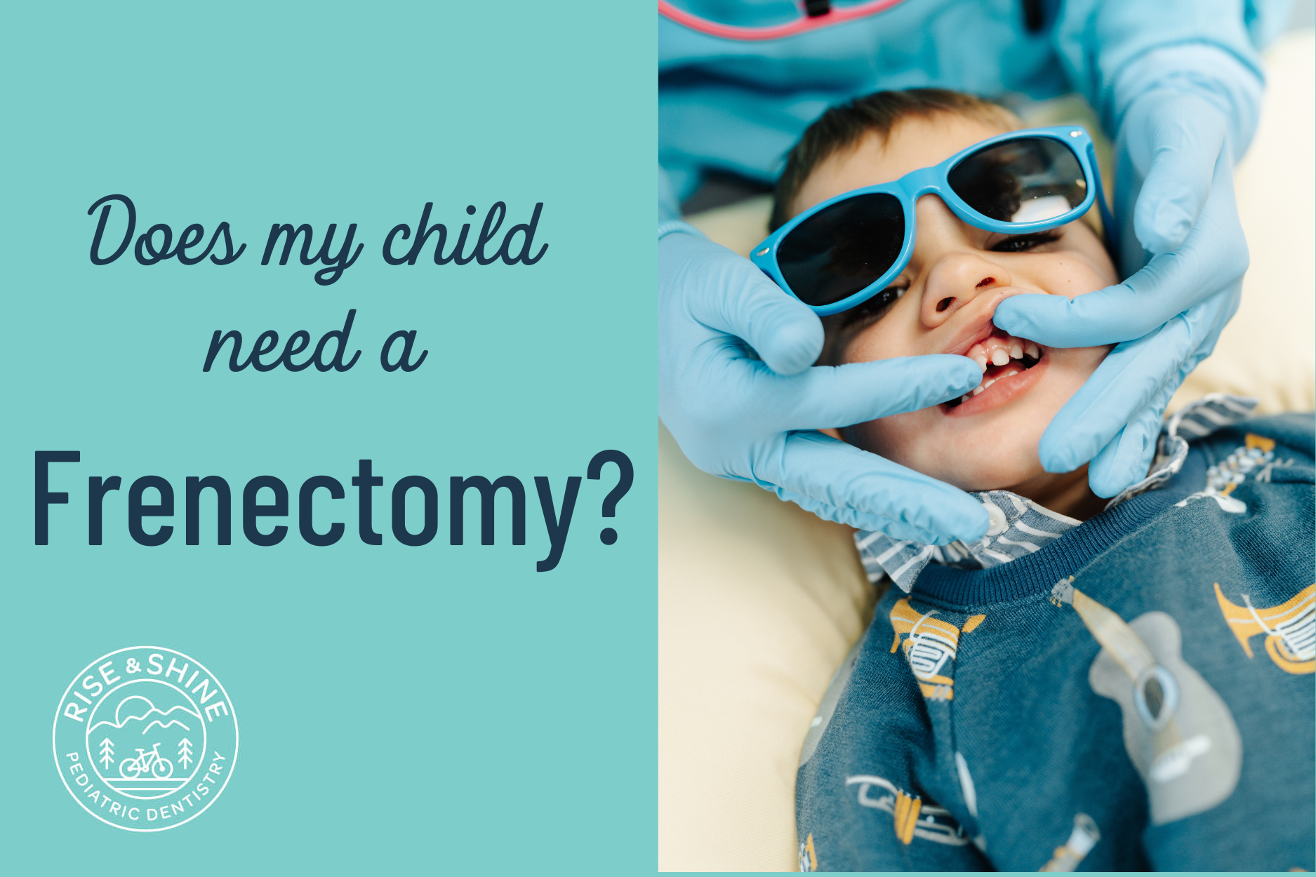 Does my child need a frenectomy