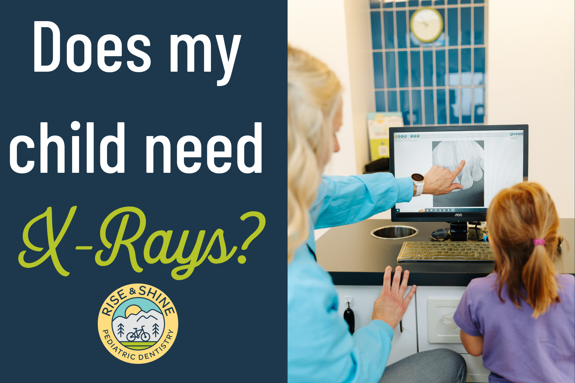 How to know if my child needs X-rays