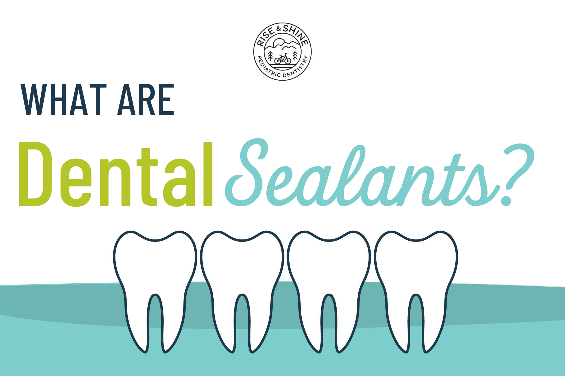 dental sealants for kids